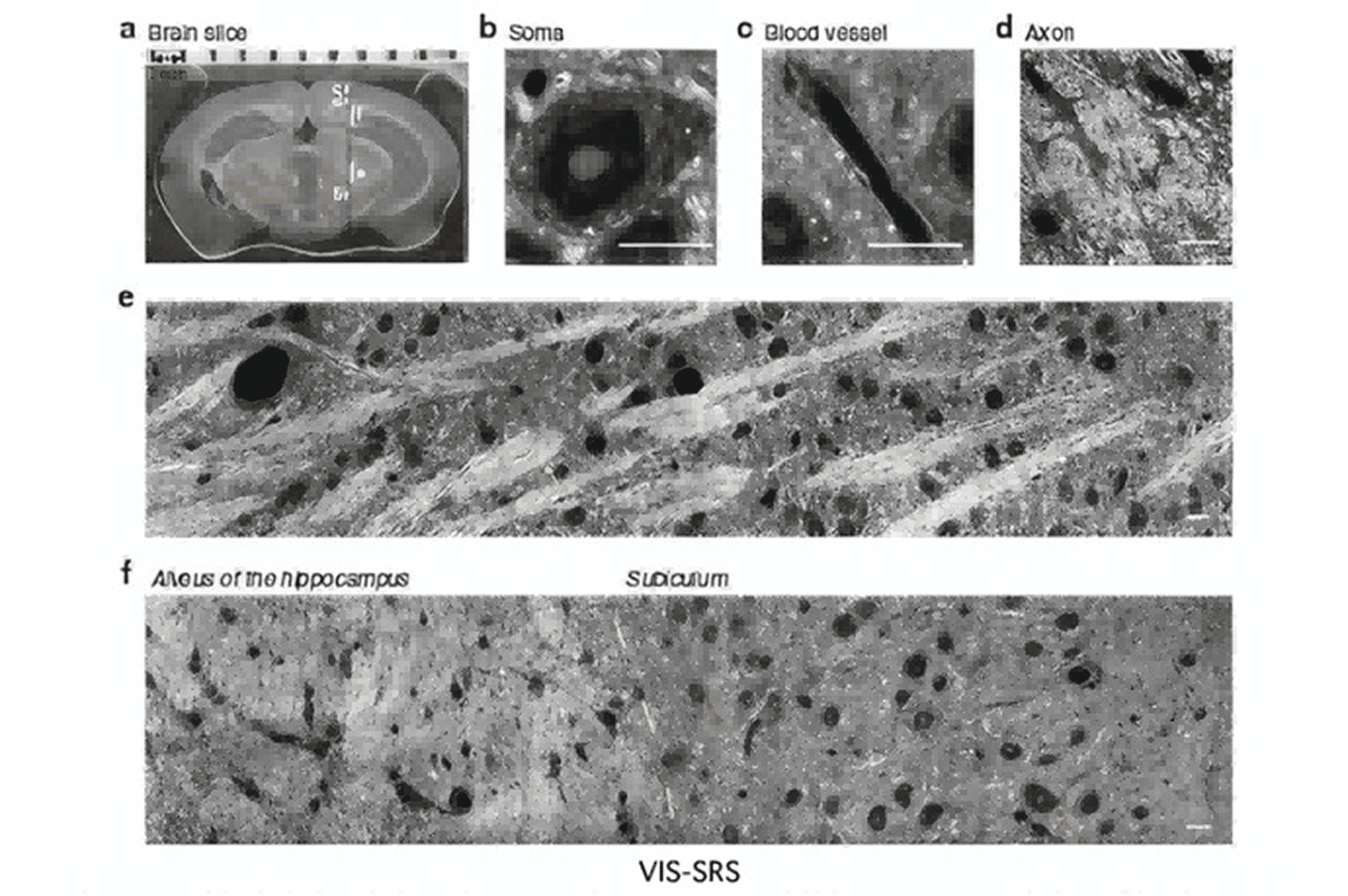Label-Free Brain Slice Imaging